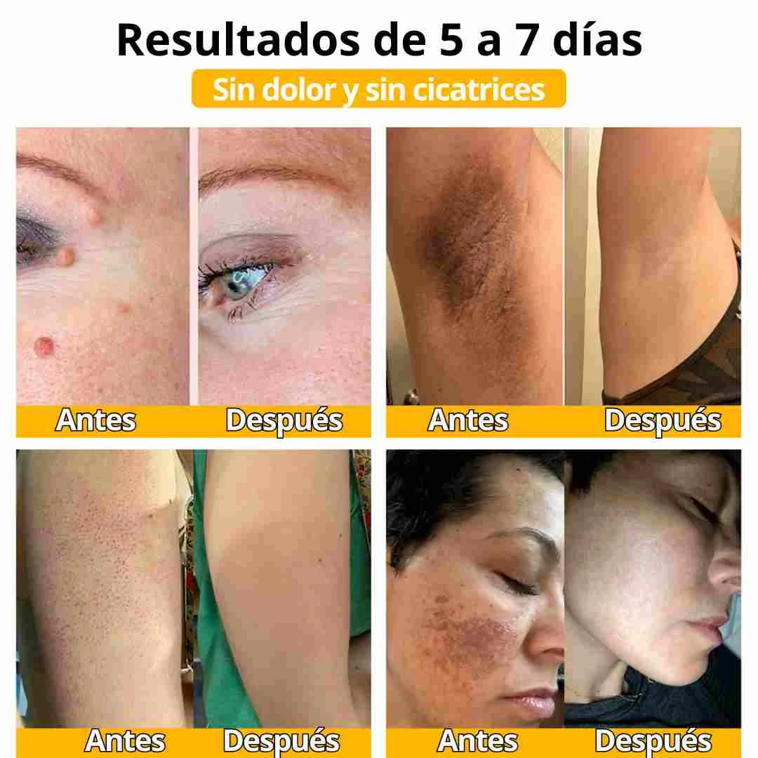 Ingredientes Premium para una Piel Más Limpia y Renovada
